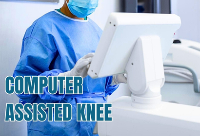 Cumputer assisted Knee Replacement Surgery by Dr Karthik Gudaru
